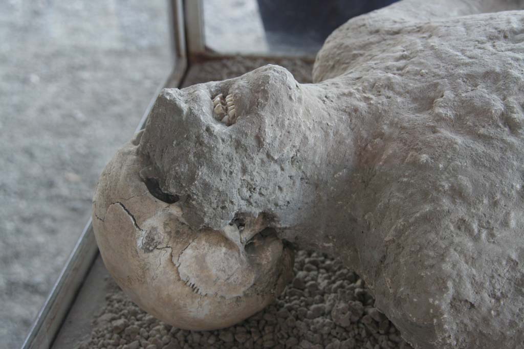 VII.9.7 and VII.9.8 Pompeii. April 2010. Detail of plaster cast of victim no.12, now in north-west corner of Macellum. 
Photo courtesy of Klaus Heese. 
