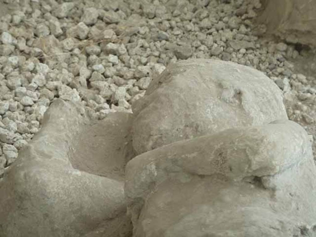 I.21.6 Pompeii. May 2010. Detail of plaster impression of a head of a child victim.